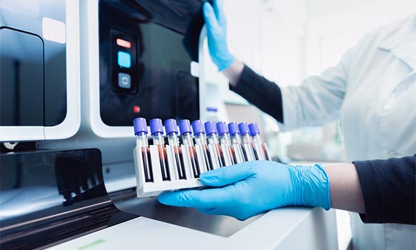 Pharmacokinetic Studies